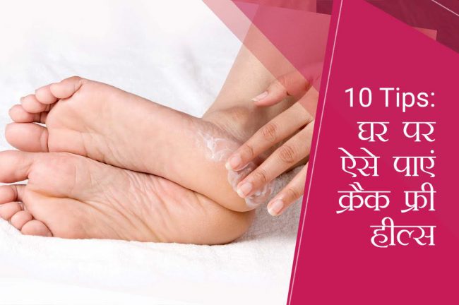 19 दिन 19 टिप्स: 10 टिप्स से घर पर पाएं क्रैक फ्री हील्स